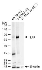 FAP Antibody in Western Blot (WB)