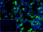 CD20 Recombinant Rabbit Monoclonal Antibody (5D10)