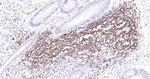 CD20 Antibody in Immunohistochemistry (Paraffin) (IHC (P))