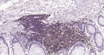 CD20 Antibody in Immunohistochemistry (Paraffin) (IHC (P))