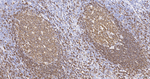 CD20 Antibody in Immunohistochemistry (Paraffin) (IHC (P))