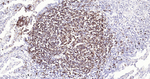 CD20 Antibody in Immunohistochemistry (Paraffin) (IHC (P))