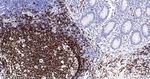 CD20 Antibody in Immunohistochemistry (Paraffin) (IHC (P))
