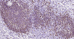 CD20 Antibody in Immunohistochemistry (Paraffin) (IHC (P))