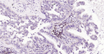 CD20 Antibody in Immunohistochemistry (Paraffin) (IHC (P))