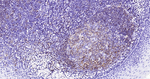CD20 Antibody in Immunohistochemistry (Paraffin) (IHC (P))