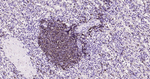 CD20 Antibody in Immunohistochemistry (Paraffin) (IHC (P))