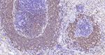 CD20 Antibody in Immunohistochemistry (Paraffin) (IHC (P))