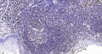 CD20 Antibody in Immunohistochemistry (Paraffin) (IHC (P))