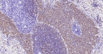 CD20 Antibody in Immunohistochemistry (Paraffin) (IHC (P))