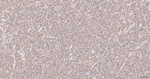 CD20 Antibody in Immunohistochemistry (Paraffin) (IHC (P))