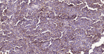 CD20 Antibody in Immunohistochemistry (Paraffin) (IHC (P))