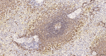 CD20 Antibody in Immunohistochemistry (Paraffin) (IHC (P))