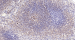 CD20 Antibody in Immunohistochemistry (Paraffin) (IHC (P))