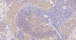 CD20 Antibody in Immunohistochemistry (Paraffin) (IHC (P))