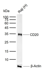 CD20 Antibody in Western Blot (WB)