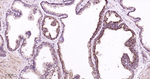 RAB7 Recombinant Rabbit Monoclonal Antibody (R2B4)