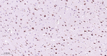 RAB7 Antibody in Immunohistochemistry (Paraffin) (IHC (P))