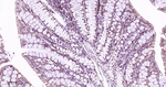RAB7 Antibody in Immunohistochemistry (Paraffin) (IHC (P))