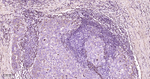 RAB7 Antibody in Immunohistochemistry (Paraffin) (IHC (P))