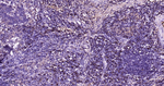 RAB7 Antibody in Immunohistochemistry (Paraffin) (IHC (P))