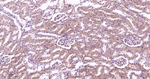 RAB7 Antibody in Immunohistochemistry (Paraffin) (IHC (P))
