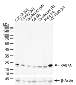 RAB7 Antibody in Western Blot (WB)