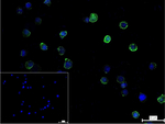 Moesin Recombinant Rabbit Monoclonal Antibody (R1F5)