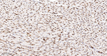Moesin Antibody in Immunohistochemistry (Paraffin) (IHC (P))