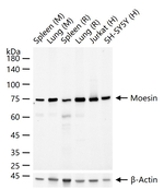 Moesin Antibody in Western Blot (WB)