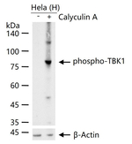 Phospho-TBK1 (Ser172) Recombinant Rabbit Monoclonal Antibody (R7D3)