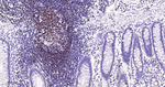 PAX5 Antibody in Immunohistochemistry (Paraffin) (IHC (P))
