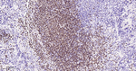 PAX5 Antibody in Immunohistochemistry (Paraffin) (IHC (P))
