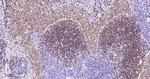 PAX5 Antibody in Immunohistochemistry (Paraffin) (IHC (P))