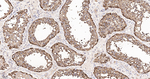 LRP1 Antibody in Immunohistochemistry (Paraffin) (IHC (P))