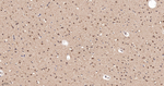 LRP1 Antibody in Immunohistochemistry (Paraffin) (IHC (P))