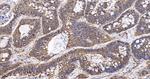 LRP1 Antibody in Immunohistochemistry (Paraffin) (IHC (P))