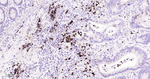 Thymidylate Synthase Antibody in Immunohistochemistry (Paraffin) (IHC (P))