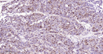 Thymidylate Synthase Recombinant Rabbit Monoclonal Antibody (R2F5)