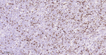 Thymidylate Synthase Antibody in Immunohistochemistry (Paraffin) (IHC (P))