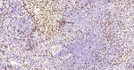 Thymidylate Synthase Antibody in Immunohistochemistry (Paraffin) (IHC (P))