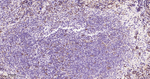 Thymidylate Synthase Antibody in Immunohistochemistry (Paraffin) (IHC (P))