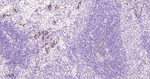 Thymidylate Synthase Antibody in Immunohistochemistry (Paraffin) (IHC (P))