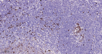 Thymidylate Synthase Antibody in Immunohistochemistry (Paraffin) (IHC (P))