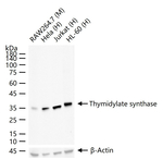 Thymidylate Synthase Antibody in Western Blot (WB)