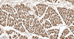 PDHA1 Antibody in Immunohistochemistry (Paraffin) (IHC (P))