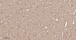 FKBP4 Antibody in Immunohistochemistry (Paraffin) (IHC (P))