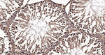 FKBP4 Antibody in Immunohistochemistry (Paraffin) (IHC (P))