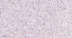 ATG9A Antibody in Immunohistochemistry (Paraffin) (IHC (P))