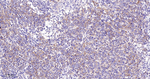 ATG9A Recombinant Rabbit Monoclonal Antibody (R4D8)
